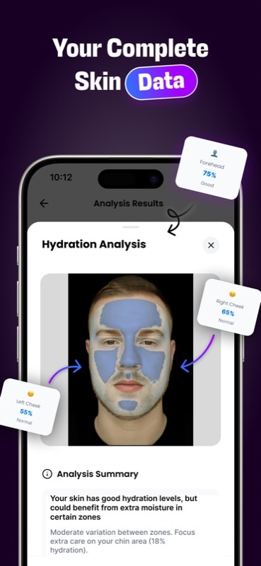 SkinPal AI face scanner app dashboard showing daily skin analysis with acne tracking, texture monitoring, and progress charts for skincare routine optimization