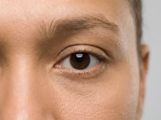 Round eye shape: tall opening, white visible above and below the iris