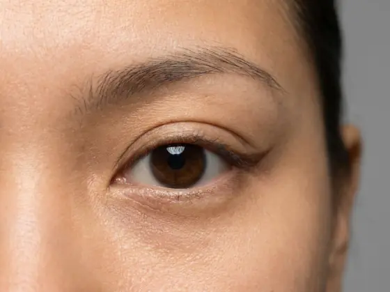 Upturned eye shape: outer corner clearly higher than the inner corner